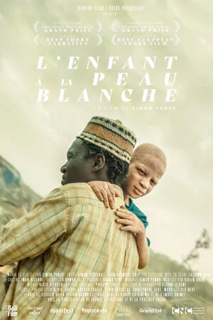 L'Enfant à la peau blanche